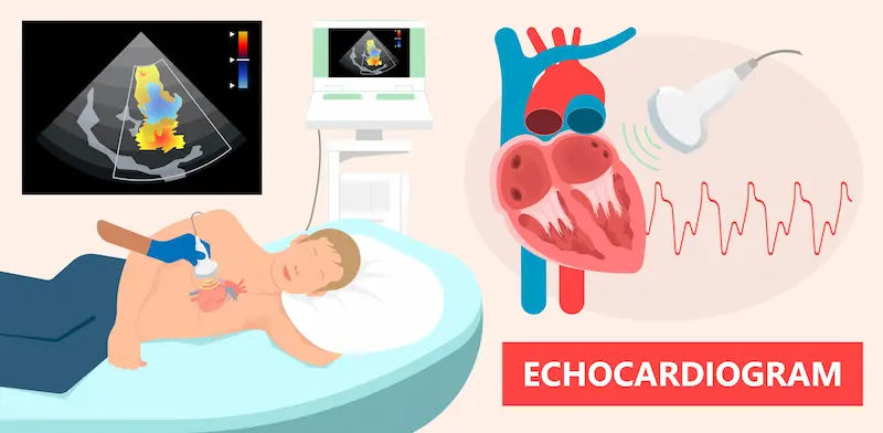 Echocardiogram Overview and Procedure Details